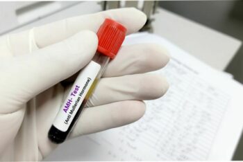 AMH Testing - What Does it Tell Me?